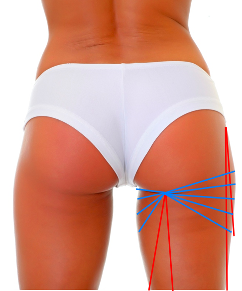 Como eliminar las cartucheras del cuerpo